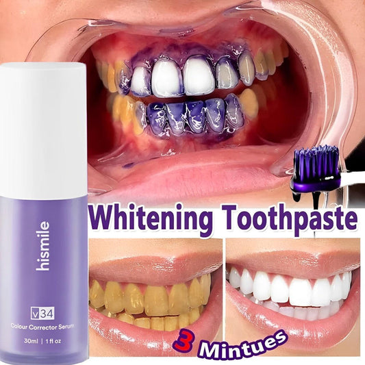 HiSmile V34™ – No More Yellow Stains, Just Bright Smiles